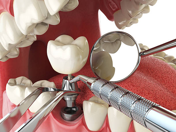 Best Emergency Broken Tooth Repair in Columbia, TN