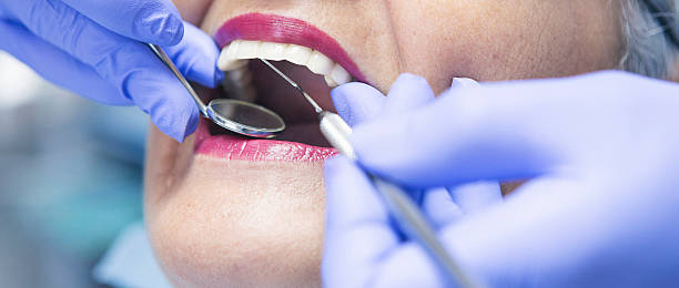 Best Emergency Tooth Extraction in Columbia, TN